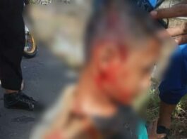 Dikeroyok, Pelajar Seluma Bocor Kepala
