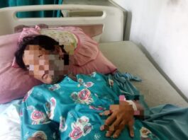 Suami Tega Siram Tubuh